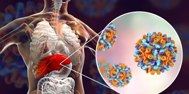 Hepatit B takip edilmezse siroz ve karaciğer kanserine neden olabilir 3